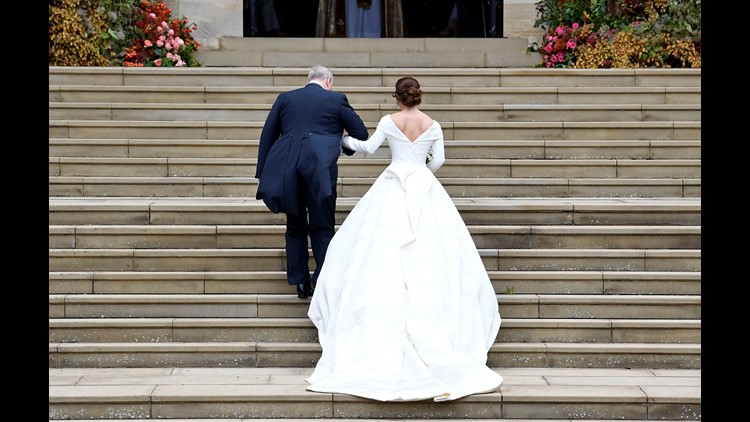 Scoliosis Wedding Dresses