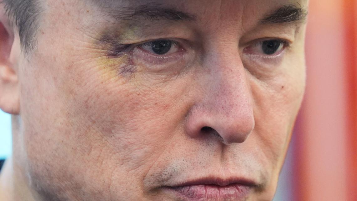 Elon Musk explains his black eye at Oval Office goodbye event with