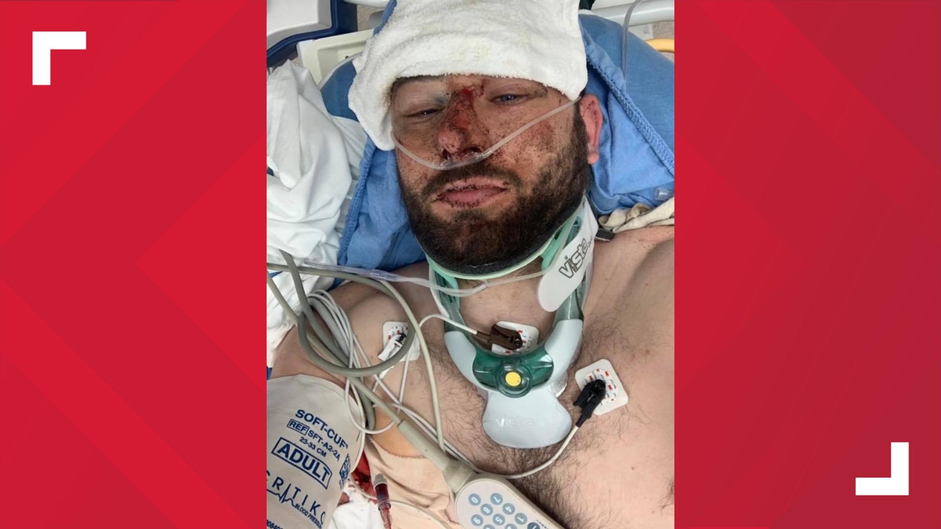 A Scottish cyclist said he was attempting to ride his bike around the world when he was hit by a car near Temple on Saturday night. He said he is lucky to be alive.