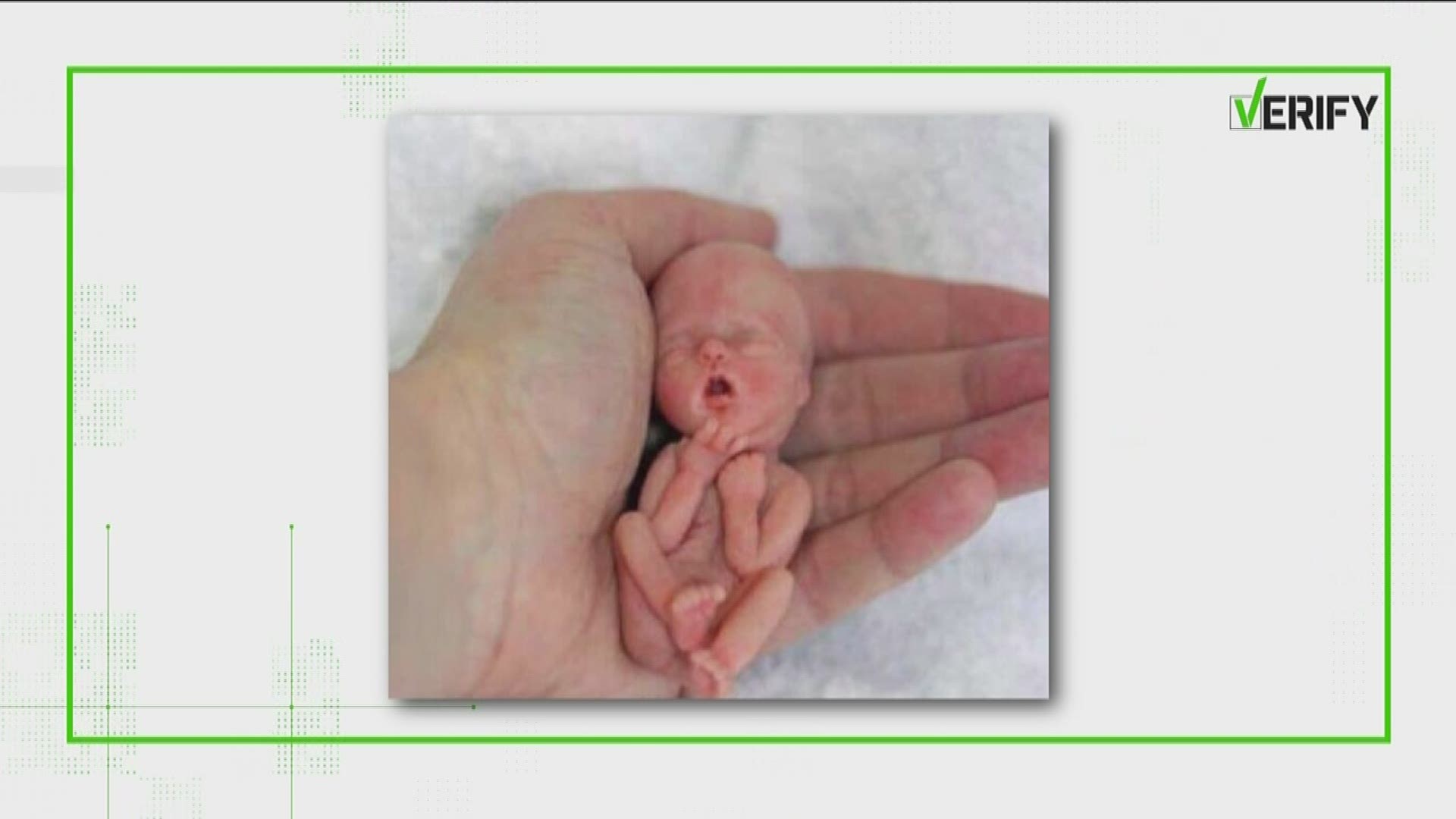 An image of a 12-week-old fetus outside the womb is making the rounds on the internet, but is it real? Chris Rogers verifies.