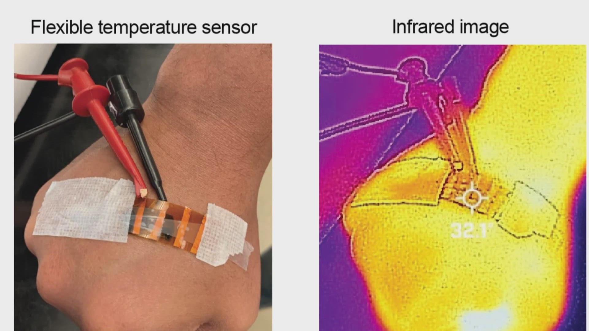 The Biomedical Engineering Program has created 3-D printed electric skin that can change the healthcare world.