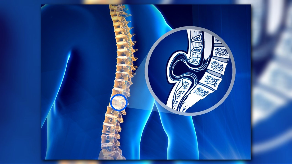 Help improve your health by looking at these five health facets