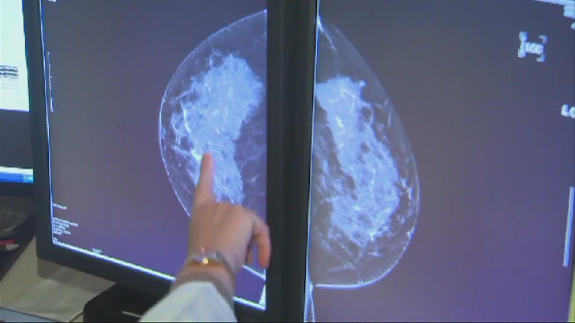 Doctors say in the last two years women put off getting mammograms due to the pandemic. But early detection is key.