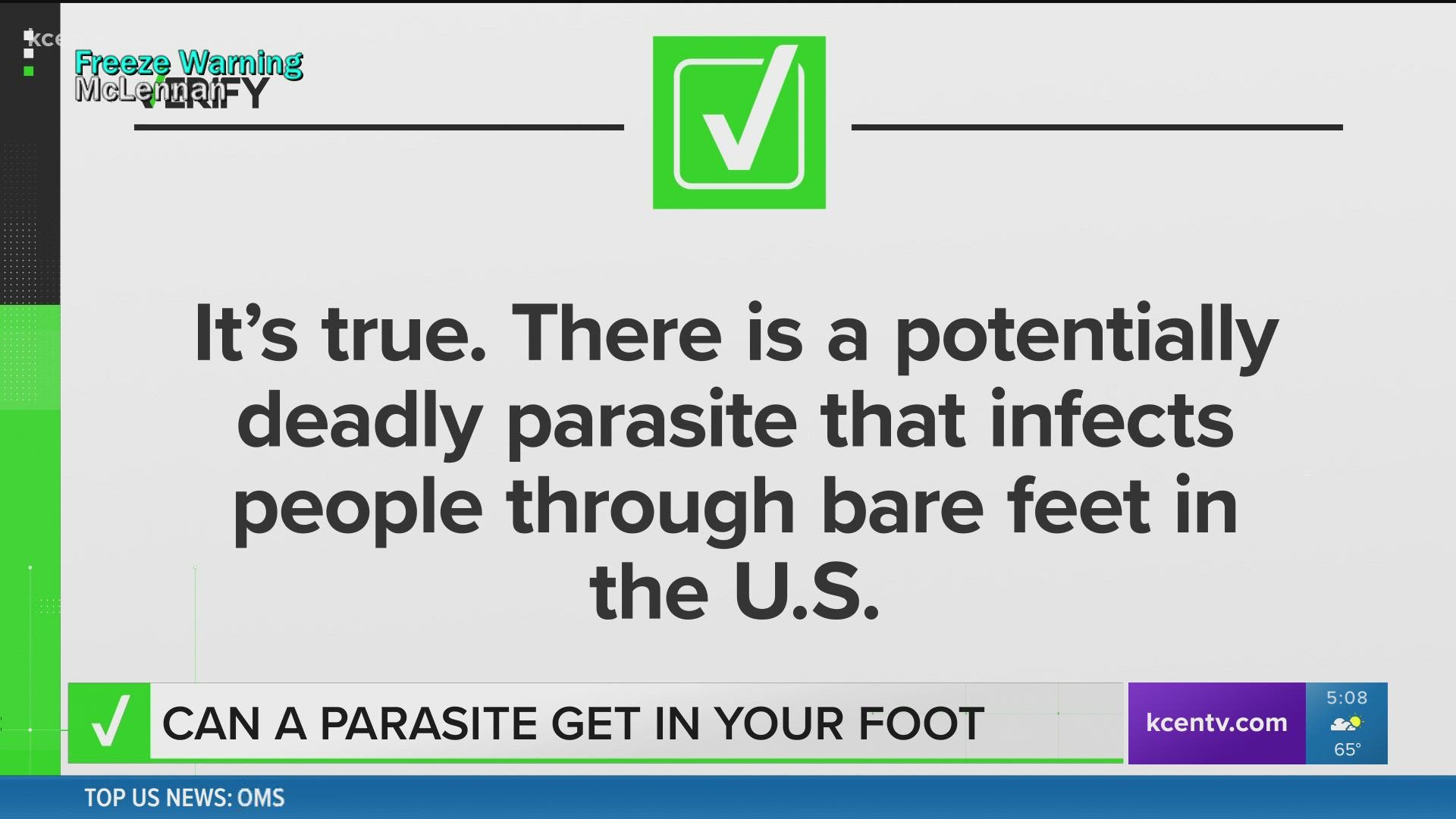 Headlines about a parasite called Strongyloides being in the U.S. are accurate. The parasite isn’t deadly for most people – and many people don’t even have symptoms.