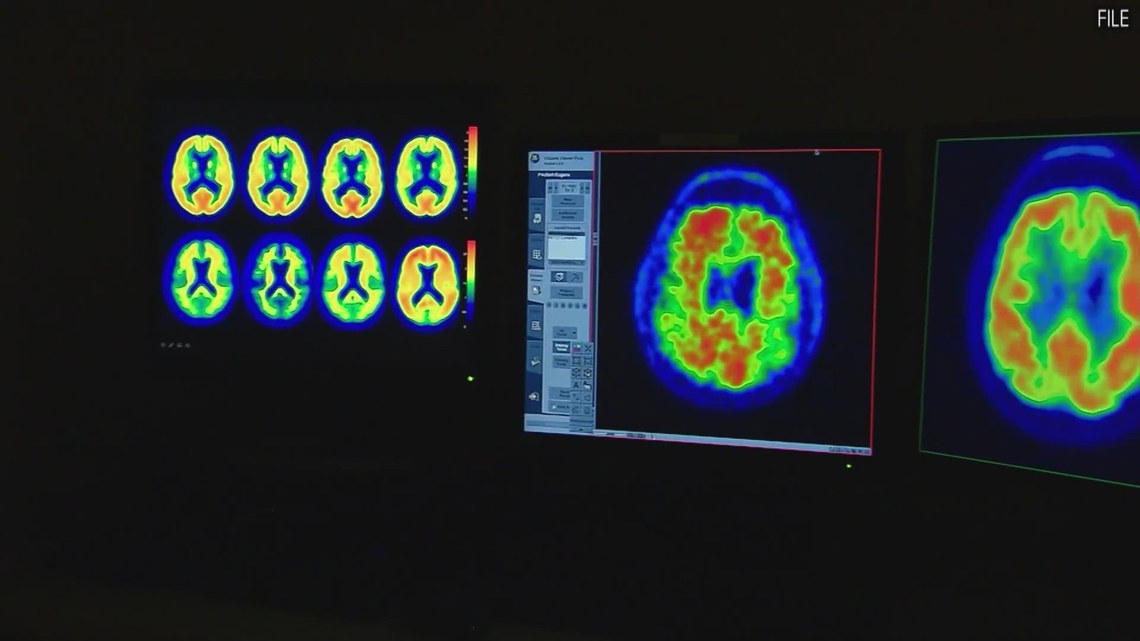 Texas Proposition 14: What you need to know about the $3 billion dementia research initiative