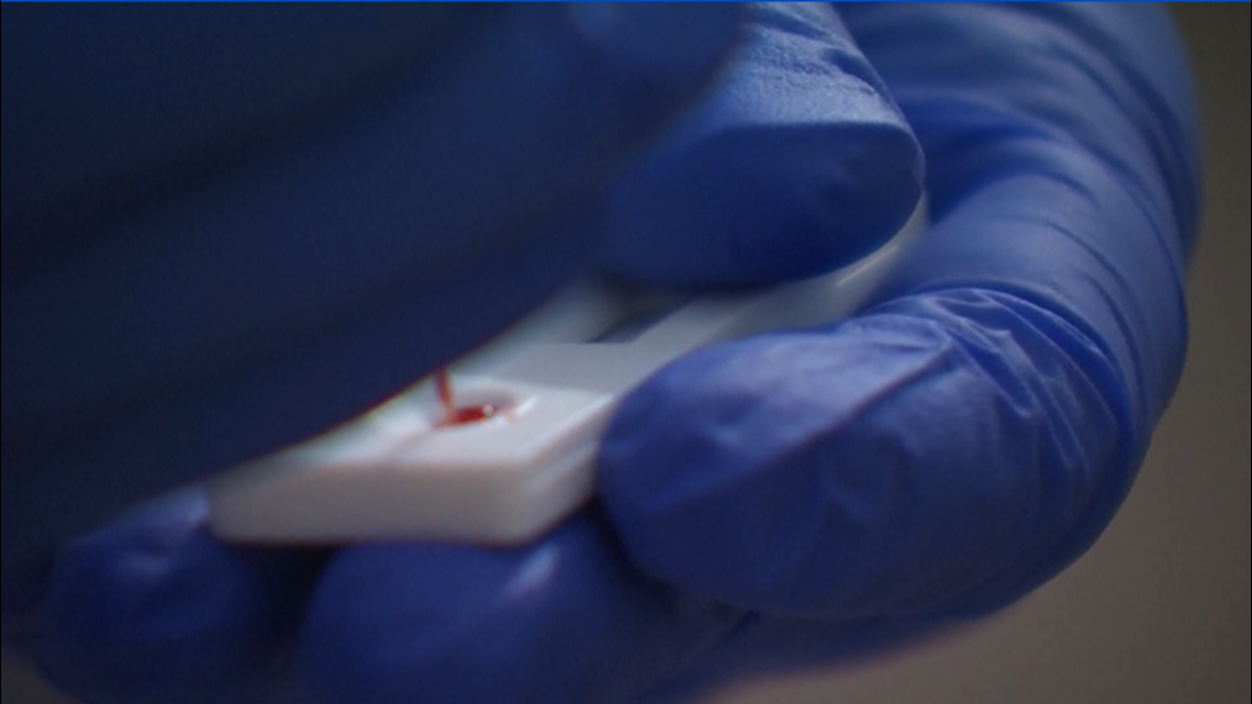 New COVID19 antibody test gives results in 20 minutes, and it’s