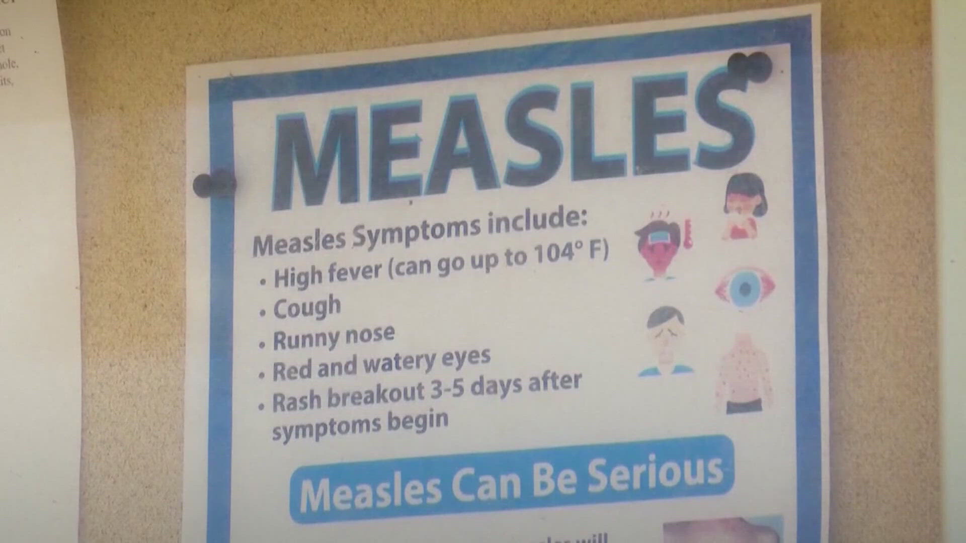 According to health officials, the case is in an unvaccinated minor and there have been no reported public exposure cases locally.