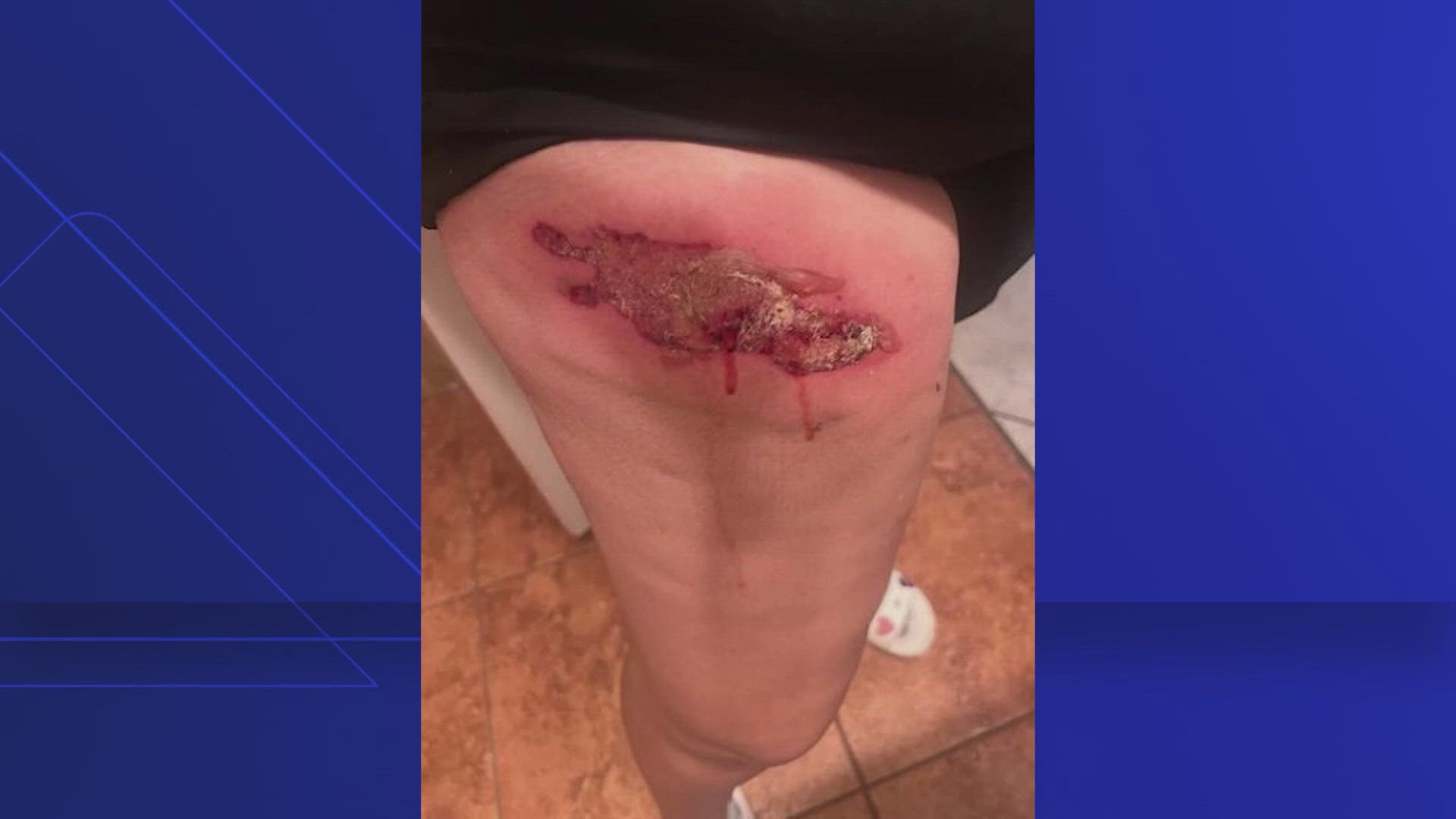 Monita reportedly pulled into a nearby parking space to eat and her lawyer said the barbeque sauce was so hot that it caused Monita to drop the container.