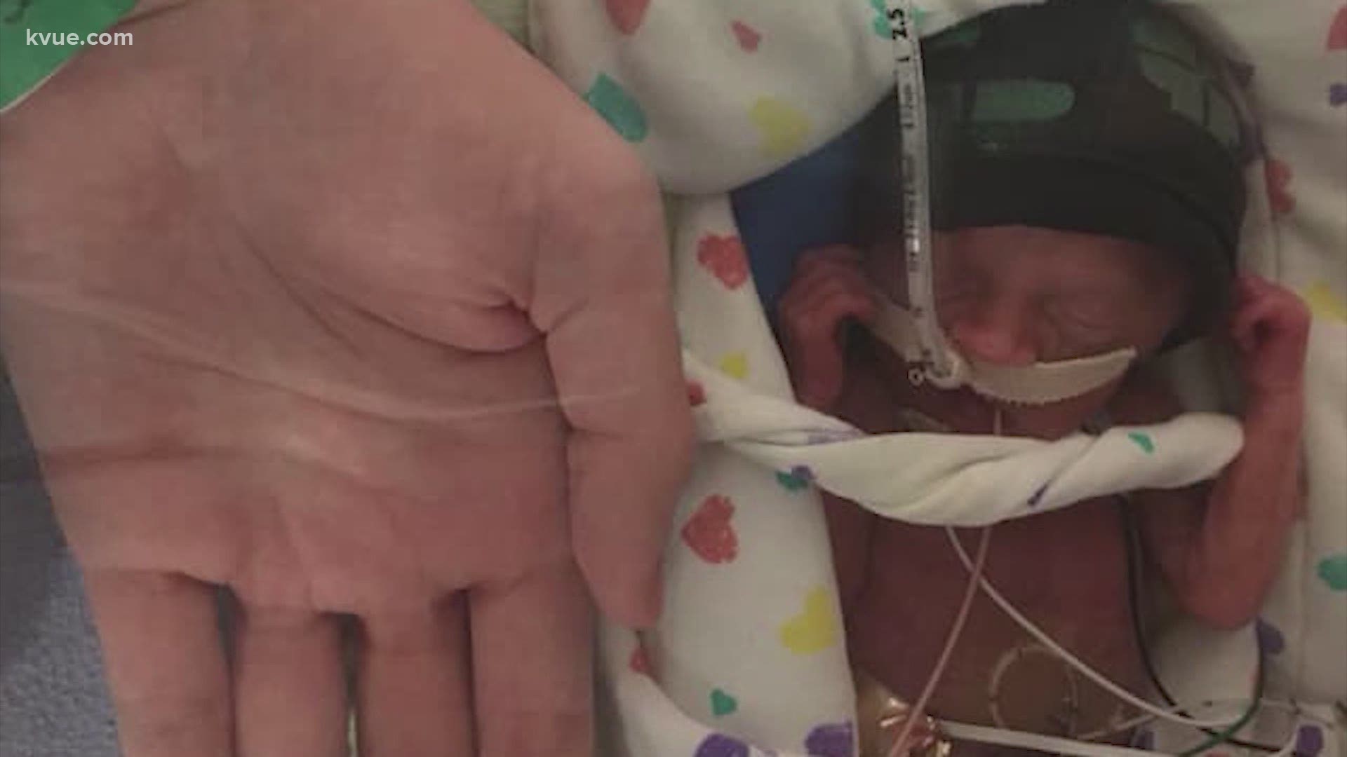 An Austin family is proof that even in the darkest times, miracles happen. Their baby came three months early, weighing less than two pounds.