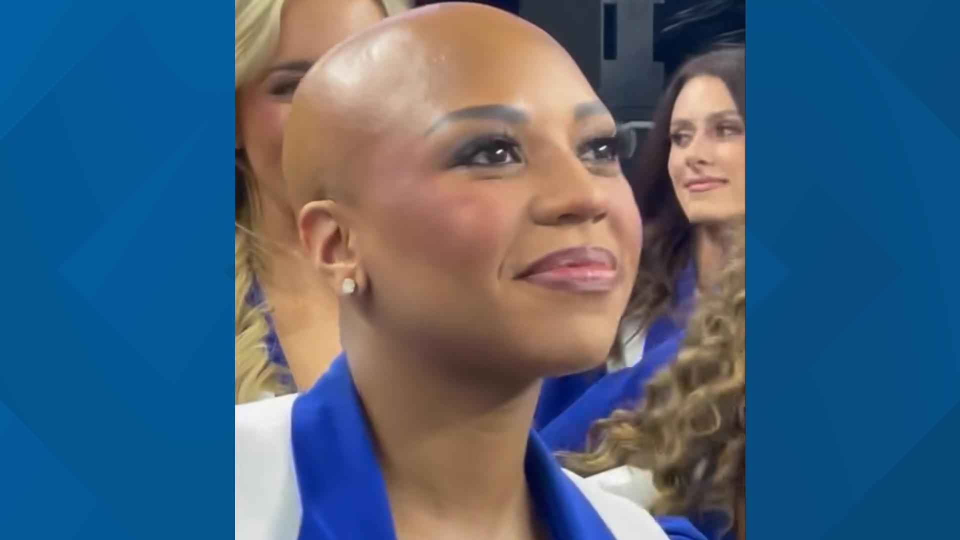 Dallas Cowboys cheerleader Armani Latimer has alopecia, an autoimmune disease that causes hair loss. Monday, she cheered without a wig for the first time.